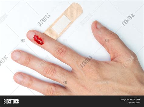 Man Cut His Finger Image & Photo (Free Trial) | Bigstock