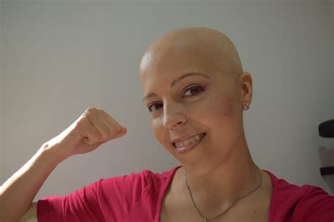 La leucemia linfoblástica aguda en adultos - Fundación Carreras