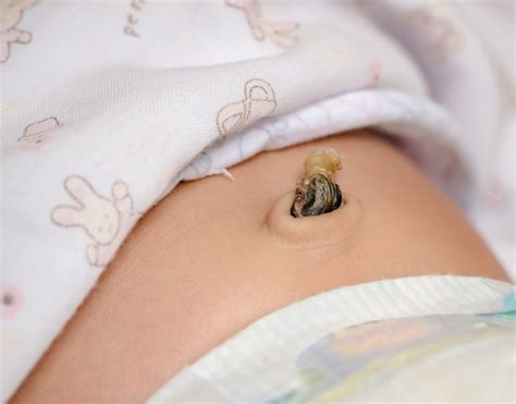 Caring for Your Newborn’s Umbilical Cord: What to Expect Until It Falls Off — NEOwell