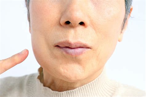 Swollen Jaw: Causes, Symptoms, and Effective Treatments for One-Sided ...