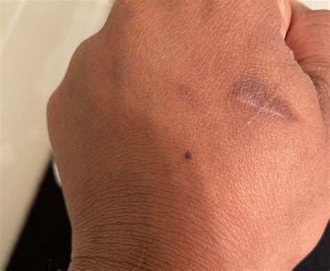 Does anyone know what these tiny black dots are? : r/skin