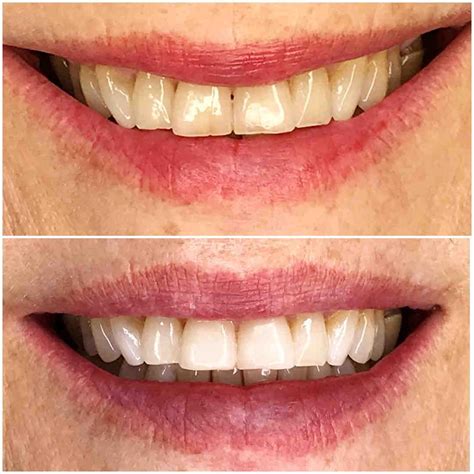 Top 5 cosmetic dentistry procedures that will improve your overall health - Dental News Network