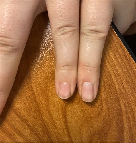 What Is A Long Pinky Nail For at Pauline Tomlinson blog