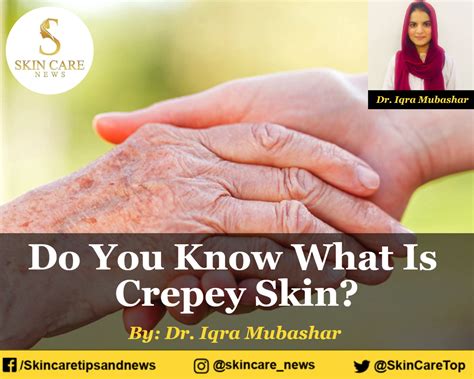 Do You Know What Is Crepey Skin?