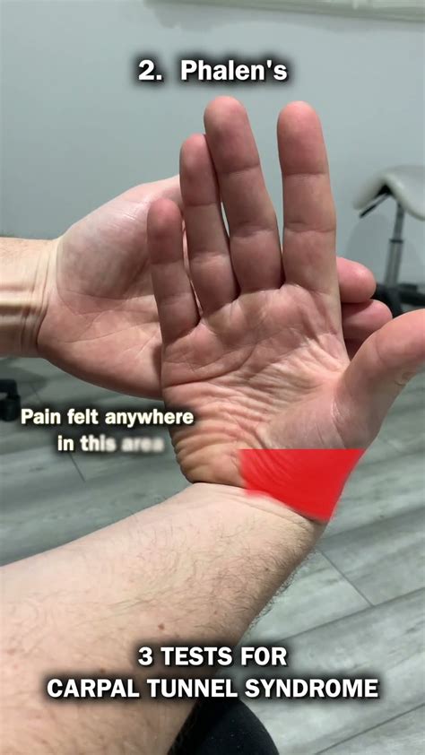3 Tests For Carpal Tunnel Syndrome! - YouTube