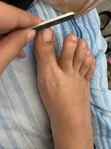 Where Is The Toenail Bed at Linda Siddiqui blog
