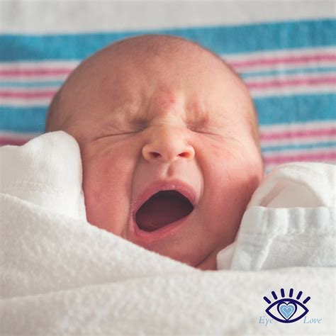 Does Your Baby Have Eye Boogers – Eye Love