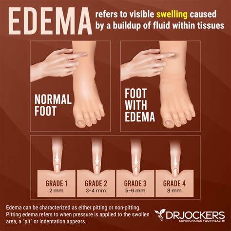 Why Is Edema Dangerous
