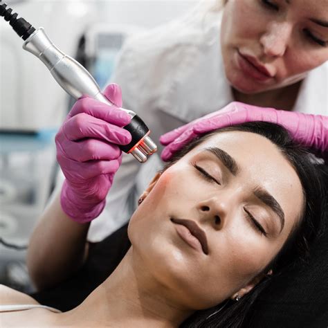 Radio Frequency Treatments for Different Skin Types – SculptSkin
