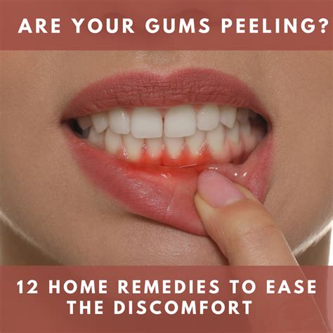 Are Your Gums Peeling? How to Fix Them Before It’s Too Late - YouMeMindBody