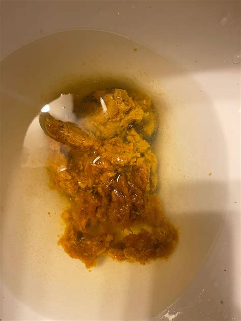 Bloody Mucus In Stool Human