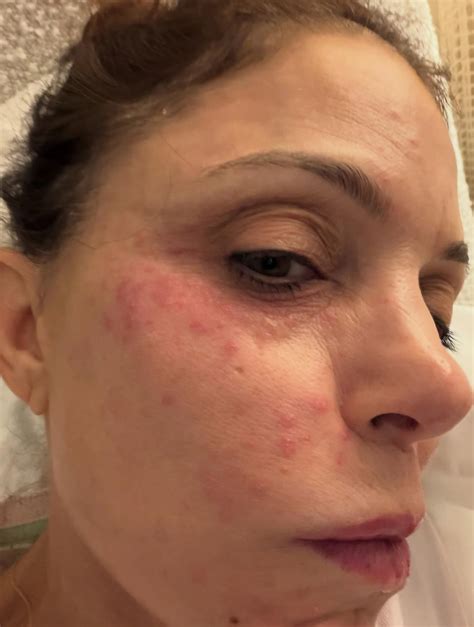 Bethenny Frankel Health