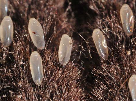 Head Lice Eggs Close Up