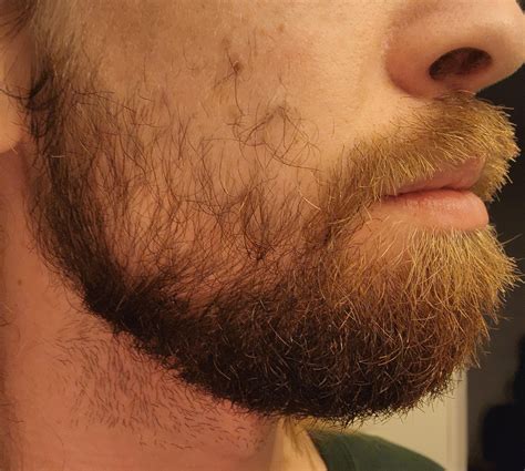Beard Styles Chin Strap Beard Or Fat Chin Strap? : R/beards
