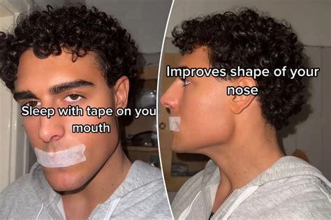 Mouth taping floated on TikTok as way to improve men's jawlines