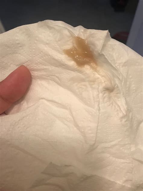 mucus plug vs discharge - prenatal vitamins