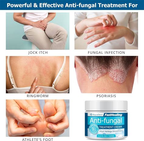 Roycederm Antifungal Cream - Powerful Ringworm & Jock Itch Treatment for Humans | Extra Strength ...