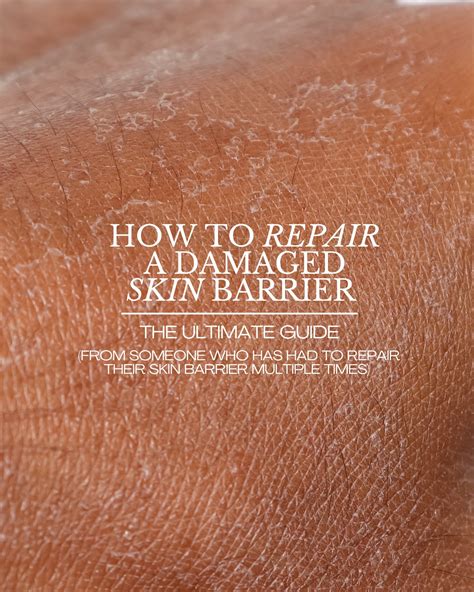 Skin Burns After Skincare? It May Be a Damaged Skin Barrier! - Kanvas Beauty Australia