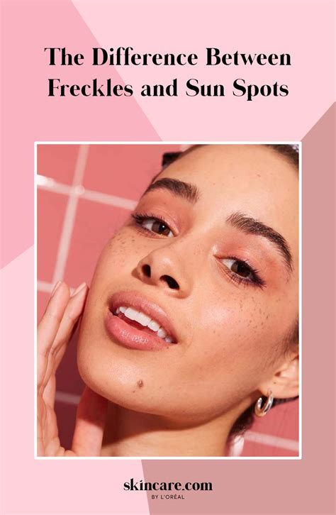 Sebaceous filaments vs blackheads what s the difference – Artofit