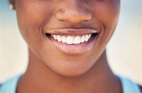 Are Veneers Permanent? | McKenzie Towne Family Dental | AB