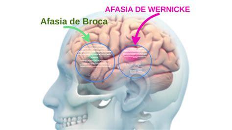 Afasia de Broca by natalia viana on Prezi