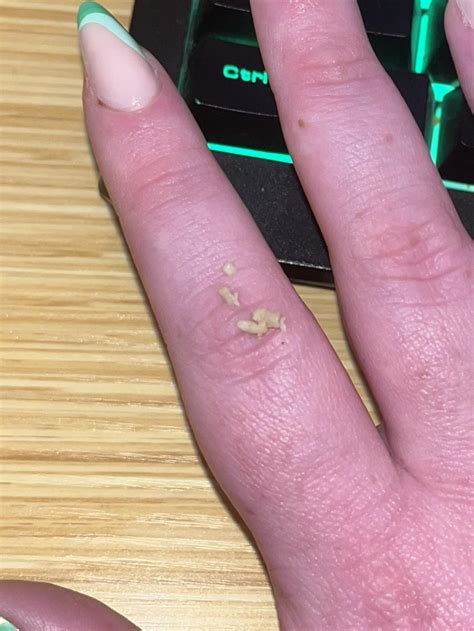 The left side of my throat has been so sore for the last few days, and I could feel how stuffed ...