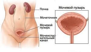 Инстилляция мочевого пузыря: что это такое и зачем делают