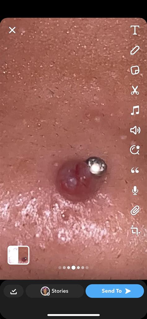 irritation bump on nose piercing isn't healingggg help mee pls : r ...