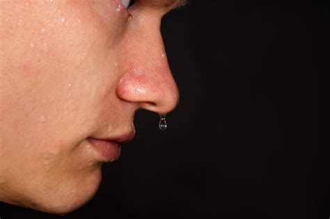 Nose Dripping Clear Fluid