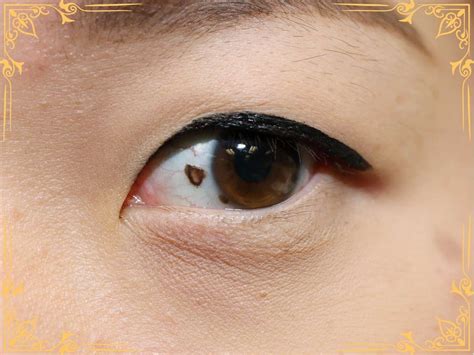Mole in Eye Meaning: Eyeball, Eyelid, Eyebrow Moles - What Spiritual