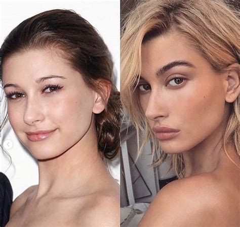 Hailey Bieber slams accusations that she underwent plastic surgery ...