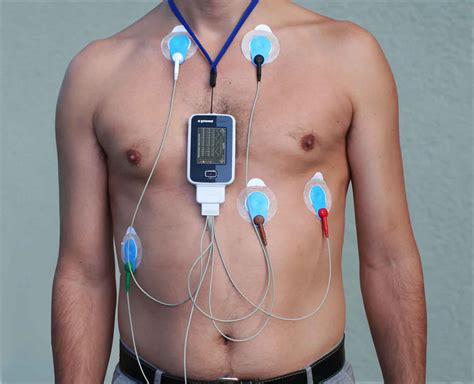 Holter Monitor Placement