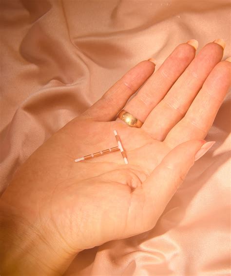 Mirena Coil Nhs Contraception | Kent Community Health NHS Foundation