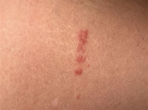 Help identify- this rash showed up at the top of my outer thigh. There are a few single red dots ...