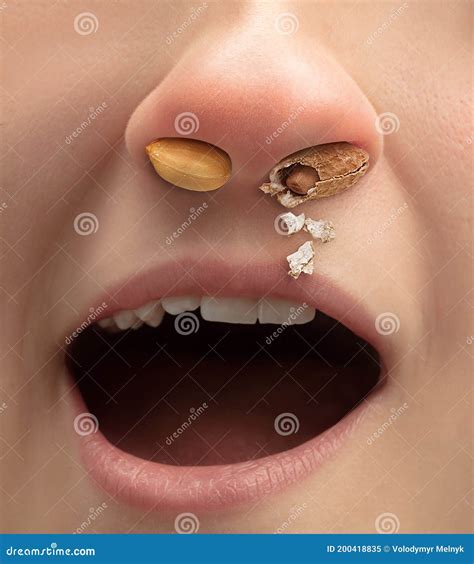 Close Up Human Nose with Allergen Causes a Runny Nose and Sneezing ...