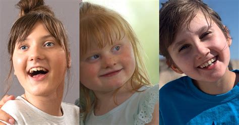 What Is Rett Syndrome? | Rett Revealed