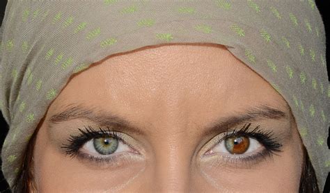 My heterochromia eyes