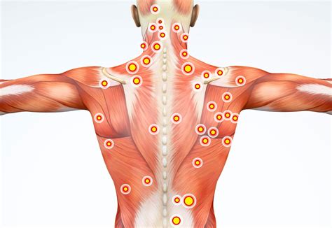 Trigger Points In Back