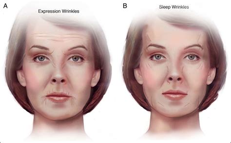 Asymmetrical Face Causes Facial Asymmetry: Causes & Treatments