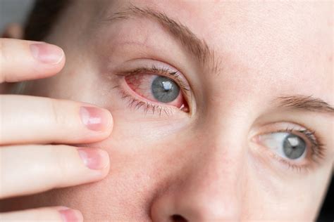 Dry Eye Disease Treatment in Aurora, CO | Highline Vision Center