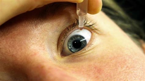 New contact lenses prevent contact lens-induced dry eye