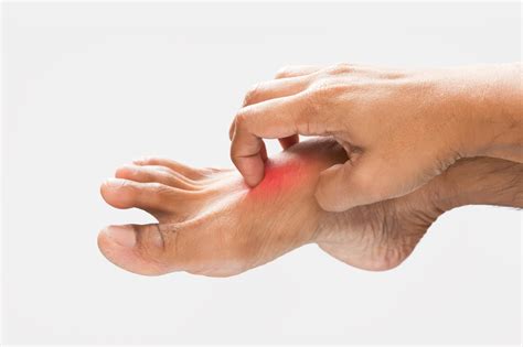 Dolor en el Empeine del Pie: 7 Causas y Tratamiento - eFISIO ...