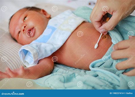 Treatment of Newborn Baby Navel with a Cotton Swab Stock Photo - Image ...