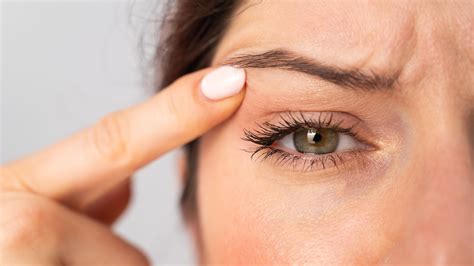How Can Botox Cause Droopy Eyelids? Facts About Eyelid Ptosis