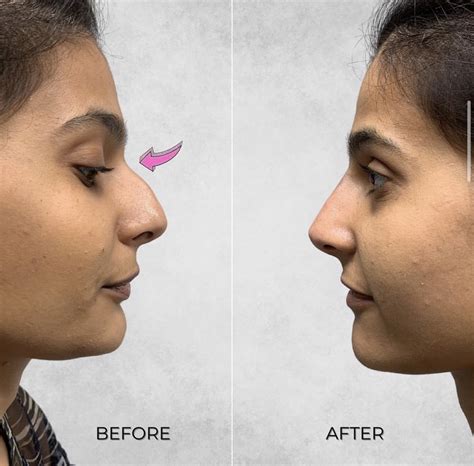 Treatment Gallery | Omniya Clinic London