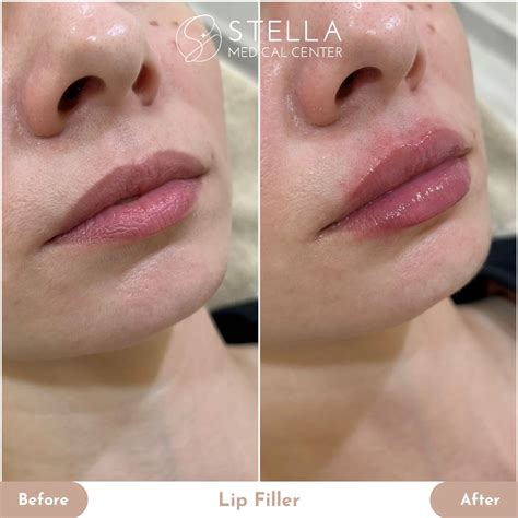 Stella Medical Center (@stella_medical_center) • Instagram photos and videos