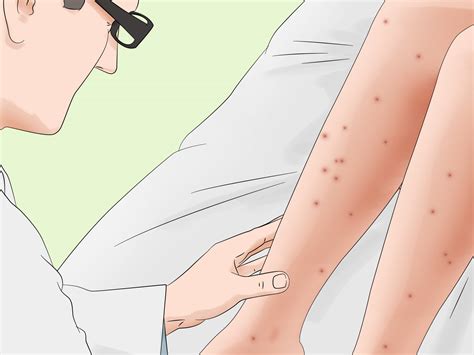 How to Treat Sandfly Bites: Fast Treatment & Natural Remedies