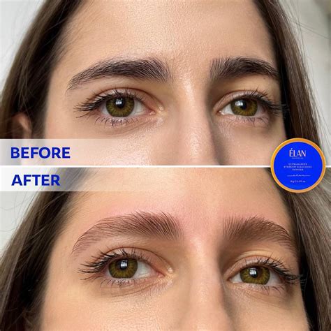 Eyebrow Lightening Before And After