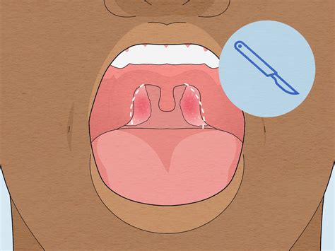 How to Drain Ear Fluid: Home Remedies & Medical Treatments