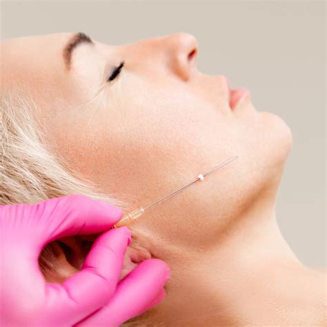 Thread Lift Canberra | Facelift Clinic | R Clinic